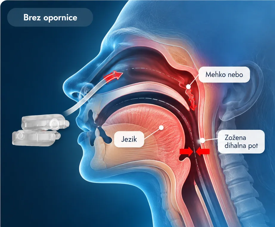 Prerez glave med spanjem brez opornice: mehko nebo in jezik zožita dihalno pot
